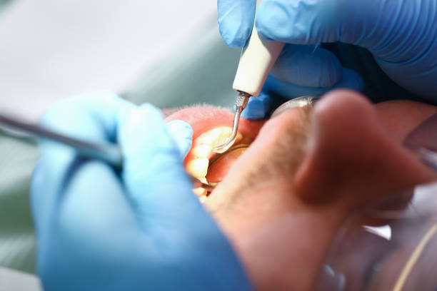 Best Emergency Treatment for Dental Infections or Abscesses in Northbrook, IL